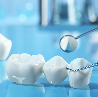 dental bridges near you
