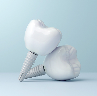 dental implants near me