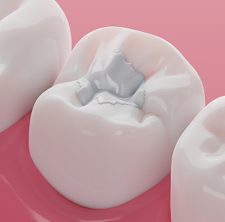 dental fillings near you