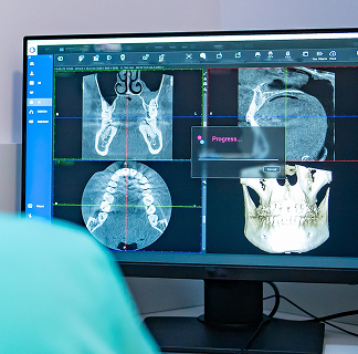dental x-rays